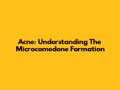 Acne: Understanding The Microcomedone Formation