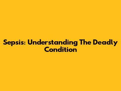 Sepsis: Understanding The Deadly Condition