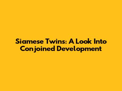 Siamese Twins: A Look Into Conjoined Development