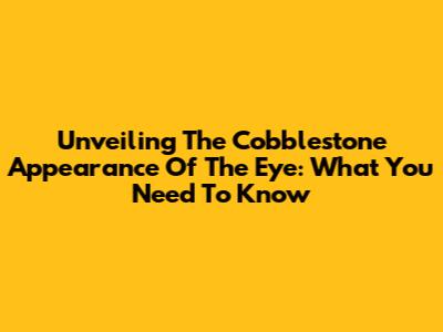 Unveiling The Cobblestone Appearance Of The Eye: What You Need To Know